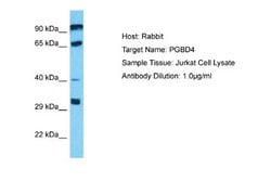 PGBD4 Rabbit anti-Human, Polyclonal, Novus Biologicals 0.1 mL | Buy Online | Novus Biologicals | Fisher Scientific